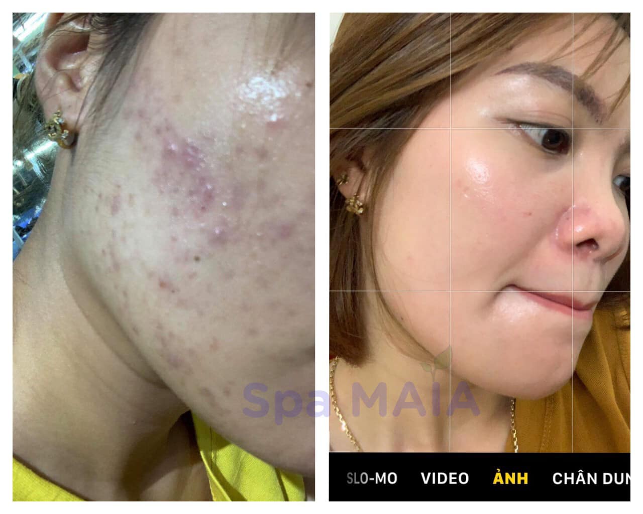 CHĂM SÓC DA MẶT